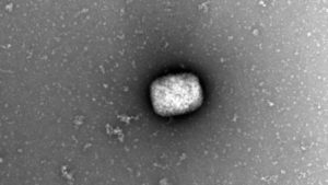 Partículas virales del virus del mono (monkeypox virus) observadas por microscopia electrónica de transmisión directamente del líquido obtenido de pústulas de pacientes infectados. EFE/ Milagros Guerra, Bruno Hernaez y Antonio Alcamí, del CBM (CSIC-UAM). EFE/ Milagros Guerra Bruno Hernaez Y Antonio Alcamí/CBM (CSIC-UAM)